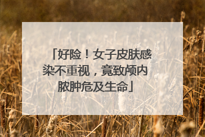 好险！女子皮肤感染不重视，竟致颅内脓肿危及生命
